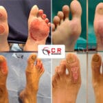 Burn & Reconstructive Surgery