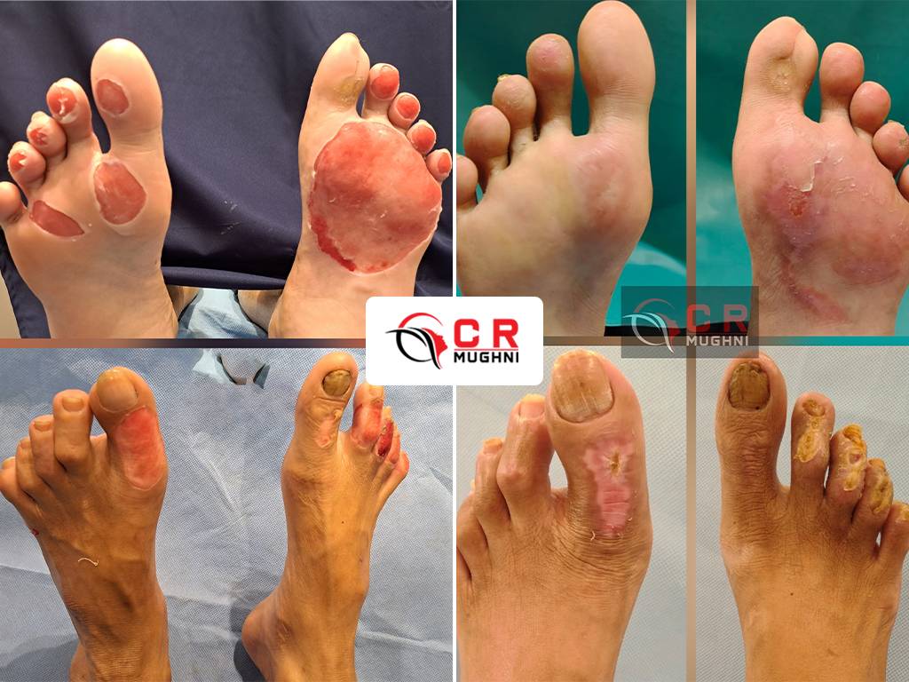 Burn & Reconstructive Surgery