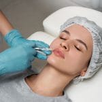Lip Augmentation